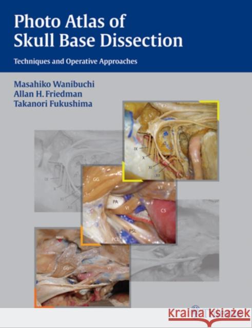 Photo Atlas of Skull Base Dissection: Techniques and Operative Approaches Wanibuchi, Masahiko 9781588905215 Thieme Medical Publishers