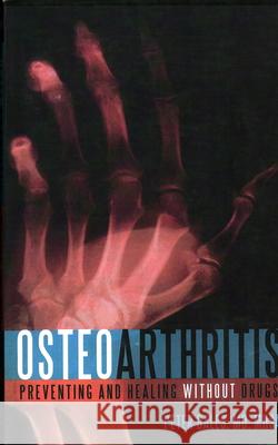 Osteoarthritis: Preventing and Healing Without Drugs Peter Bale 9781591026150 Prometheus Books