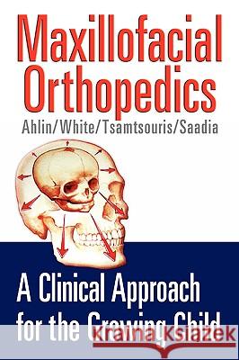 Maxillofacial Orthopedics Jeffrey H. Ahlin 9781591609407 