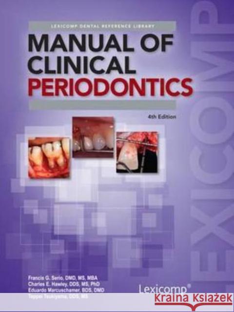 Manual of Clinical Periodontics Francis G. Serio 9781591953326 Lexi-Comp