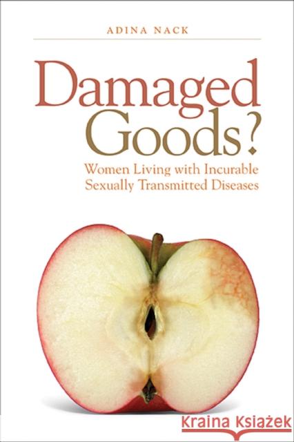 Damaged Goods?: Women Living with Incurable Sexually Transmitted Diseases Adina Nack 9781592137077 Temple University Press