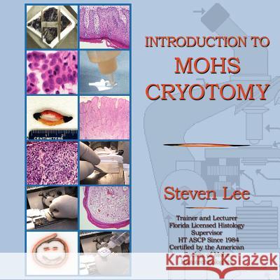 Introduction to Mohs Cryotomy Steven Lee 9781595408648 1st World Library