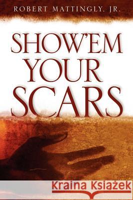 Show'em Your Scars Jr. Robert Mattingly 9781597814805 Xulon Press