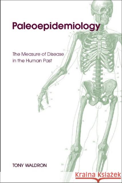 Palaeoepidemiology: The Epidemiology of Human Remains Waldron, Tony 9781598742527