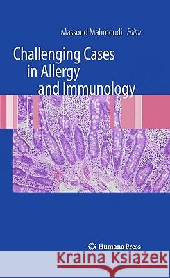 Challenging Cases in Allergy and Immunology Massoud Mahmoudi 9781603274425 Humana Press