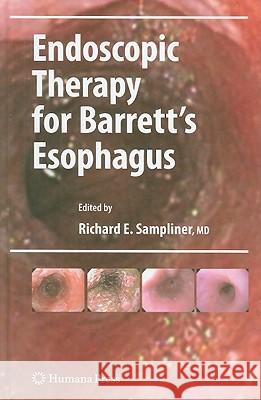 Endoscopic Therapy for Barrett's Esophagus Richard E. Sampliner 9781603274449 Humana Press