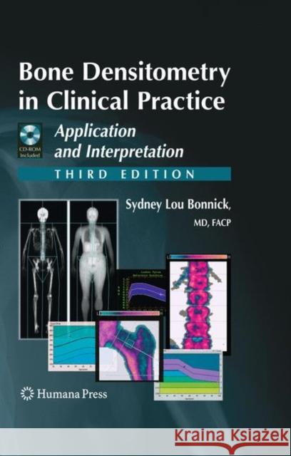 bone densitometry in clinical practice: application and interpretation  Bonnick, Sydney Lou 9781603274982 Humana Press