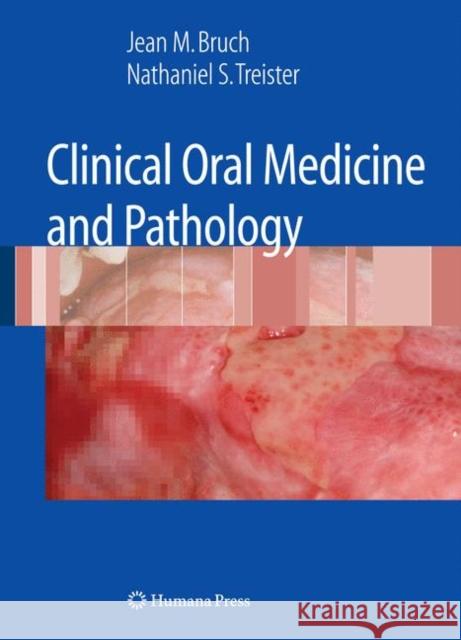 Clinical Oral Medicine and Pathology Jean M. Bruch Nathaniel S. Treister 9781603275194 Humana Press