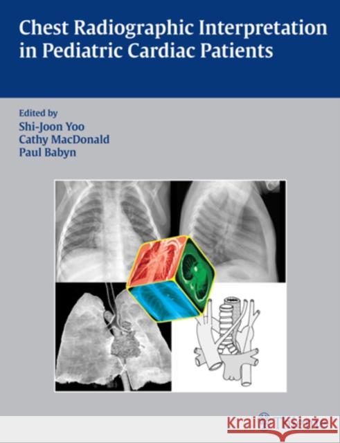 Chest Radiographic Interpretation in Pediatric Cardiac Patients Yoo 9781604060362 Thieme Medical Publishers