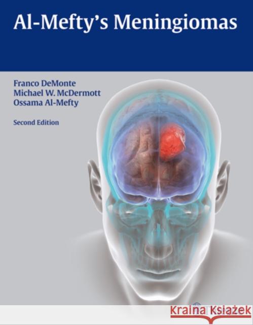 Al-Mefty's Meningiomas Ossama Al-Mefty Franco DeMonte Michael McDermott 9781604060539