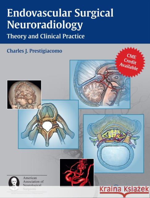 Endovascular Surgical Neuroradiology: Theory and Clinical Practice Prestigiacomo, Charles J. 9781604060577 Thieme Medical Publishers