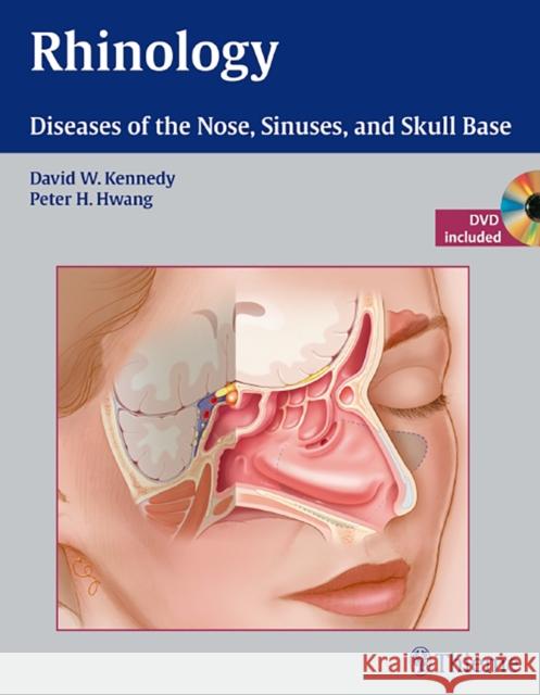 Rhinology: Diseases of the Nose, Sinuses, and Skull Base Kennedy, David 9781604060607 Thieme, Stuttgart