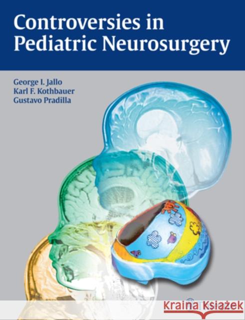 Controversies in Pediatric Neurosurgery George Jallo Karl Kothbauer Gustavo Padilla 9781604060744 Thieme Medical Publishers