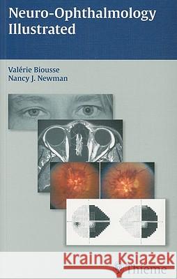 Neuro-Ophthalmology Illustrated Valerie Biousse Biousse 9781604061567 Thieme Medical Publishers