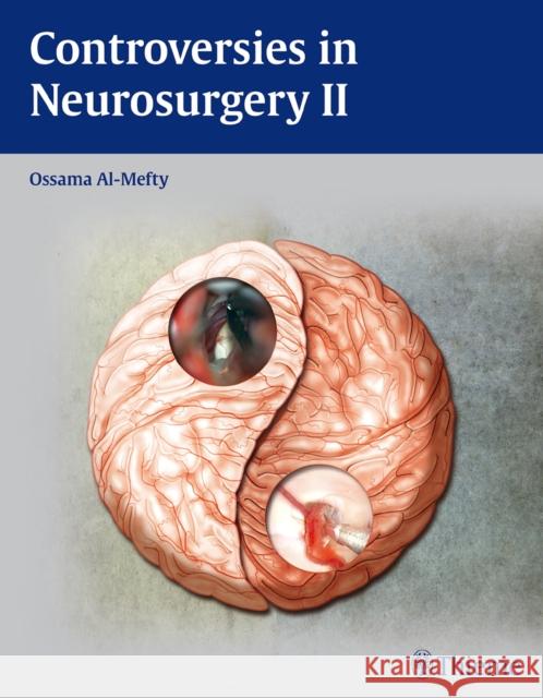 Controversies in Neurosurgery II Ossama Al-Mefty 9781604062328