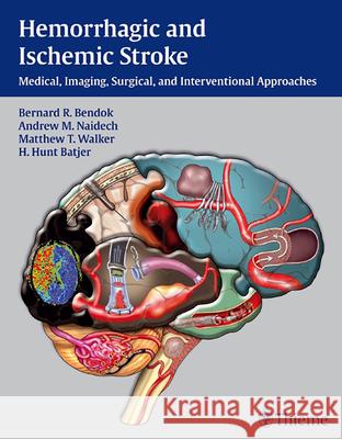Hemorrhagic and Ischemic Stroke: Medical, Imaging, Surgical and Interventional Approaches [With Web Access] Bendok, Bernard 9781604062342 0