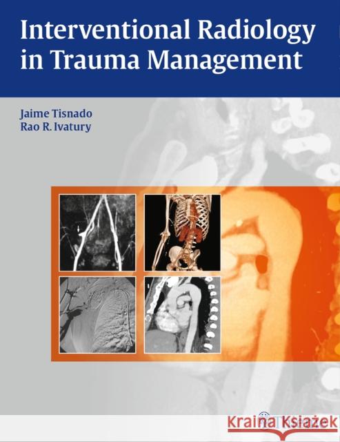 Interventional Radiology in Trauma Jaime Tisnado Rao R. Ivatury 9781604063110