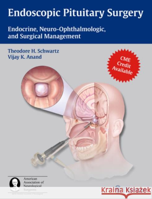 Endoscopic Pituitary Surgery: Endocrine, Neuro-Ophthalmologic, and Surgical Management [With 3-D Glasses] Schwartz, Theodore H. 9781604063479 0