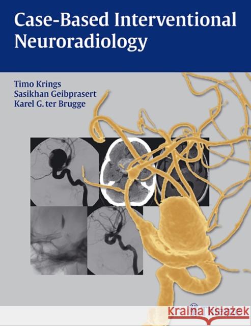 Case-Based Interventional Neuroradiology [With Access Code] Krings, Timo 9781604063738 Thieme Medical Publishers