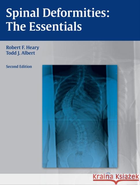 Spinal Deformities: The Essentials Heary, Robert F. 9781604064117 Thieme Medical Publishers