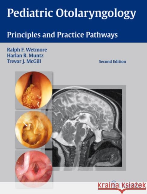 Pediatric Otolaryngology: Principles and Practice Pathways Wetmore, Ralph F. 9781604064131 Thieme Medical Publishers