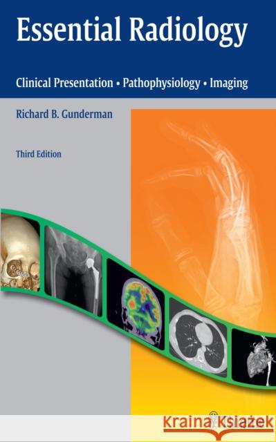 Essential Radiology: Clinical Presentation - Pathophysiology - Imaging Gunderman, Richard B. 9781604065732 Thieme Medical Publishers