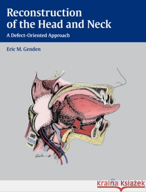 Reconstruction of the Head and Neck: A Defect-Oriented Approach Genden, Eric M. 9781604065763 Thieme Medical Publishers