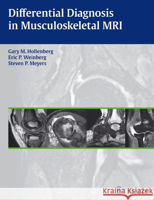 Differential Diagnosis in Musculoskeletal MR Gary M. Hollenberg Eric P. Weinberg Steven P. Meyers 9781604066838