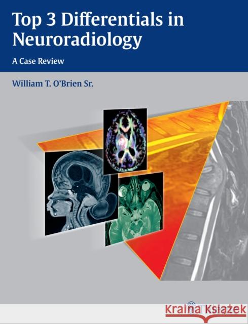 Top 3 Differentials in Neuroradiology O'Brien, William T. 9781604067231 Thieme Medical Publishers