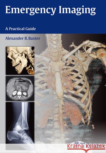 Emergency Imaging Alexander B. Baxter Trudy Cloyd 9781604067422 Thieme Medical Publishers