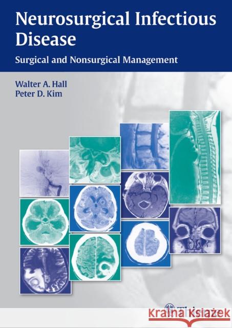 Neurosurgical Infectious Disease: Surgical and Nonsurgical Management Hall, Walter A. 9781604068054