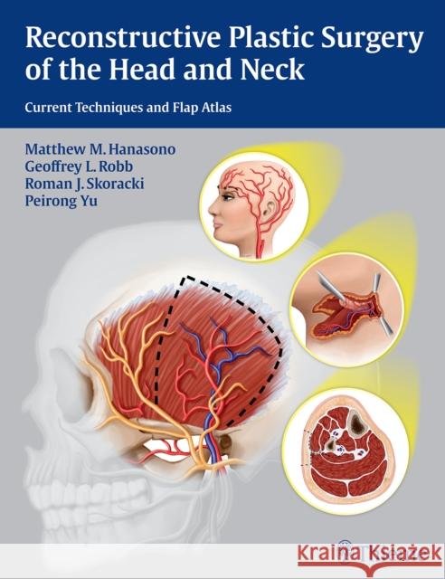 Reconstructive Plastic Surgery of the Head and Neck: Current Techniques and Flap Atlas Hanasono, Matthew M. 9781604068078 Thieme Medical Publishers