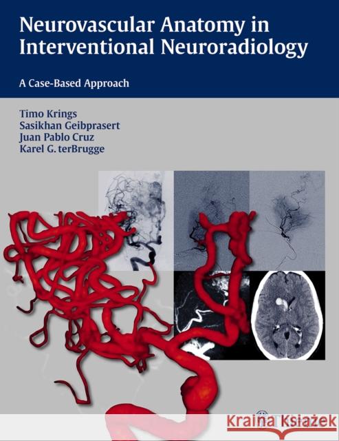 Neurovascular Anatomy in Interventional Neuroradiology: A Case-Based Approach Krings, Timo 9781604068399 Thieme Medical Publishers