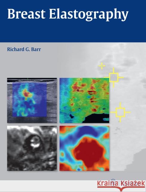 Breast Elastography Richard G. Barr 9781604068528 Thieme Medical Publishers