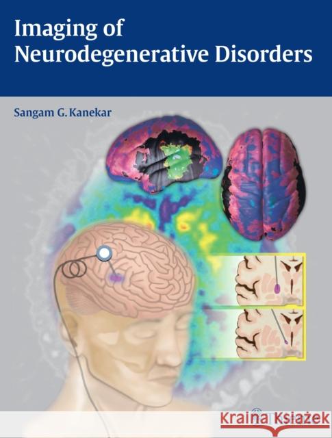 Imaging of Neurodegenerative Disorders Sangam Kanekar 9781604068542