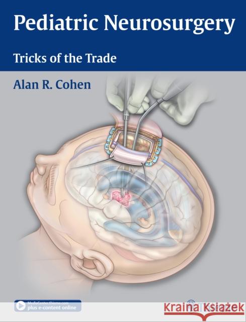 Pediatric Neurosurgery: Tricks of the Trade Cohen, Alan R. 9781604068696 Thieme Medical Publishers