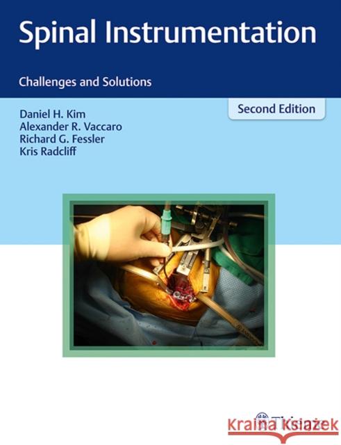 Spinal Instrumentation: Challenges and Solutions Kim, Daniel H. 9781604068955 Thieme Medical Publishers