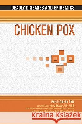 Chicken Pox Patrick Guilfoile 9781604132274 Chelsea House Publications