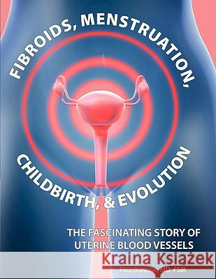 Fibroids, Menstruation, Childbirth, and Evolution: The Fascinating Story of Uterine Blood Vessels Fred Burbank 9781604941708 Wheatmark