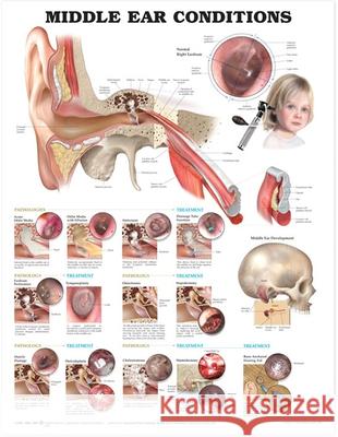 Middle Ear Conditions Anatomical Chart Anatomical Chart Company 9781605470955