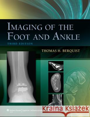 Imaging of the Foot and Ankle Thomas Berquist 9781605475721 WOLTERS KLUWER