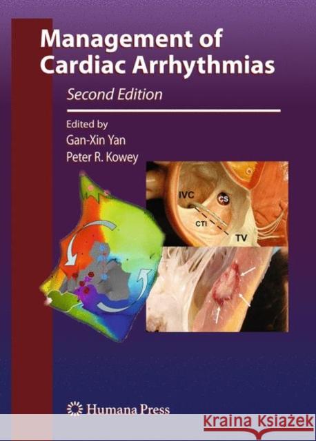 Management of Cardiac Arrhythmias Gan-Xin Yan 9781607611608 Not Avail