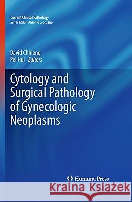 Cytology and Surgical Pathology of Gynecologic Neoplasms David Chhieng Pei Hui 9781607611639 Not Avail