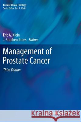 Management of Prostate Cancer Eric A. Klein 9781607612582 Springer
