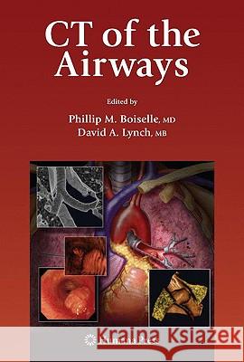 CT of the Airways Phillip M. Boiselle David A. Lynch 9781607615507 Humana Press