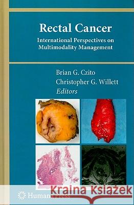 Rectal Cancer: International Perspectives on Multimodality Management Czito, Brian G. 9781607615668 Humana Press