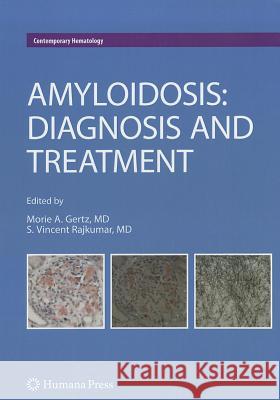 Amyloidosis: Diagnosis and Treatment Gertz, Morie A. 9781607616306 Springer