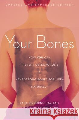 Your Bones: How You Can Prevent Osteoporosis & Have Strong Bones for Life - Naturally Lara Pizzorno Jonathan Wright 9781607660132