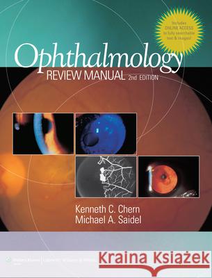 Ophthalmology Review Manual Kenneth Chern 9781608310074 