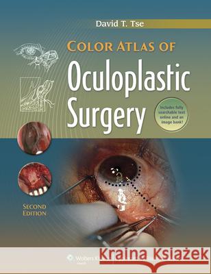 Color Atlas of Oculoplastic Surgery David Tse 9781608310784 0